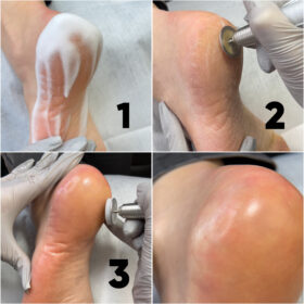 SCHIUMA EMOLLIENTE 250ML